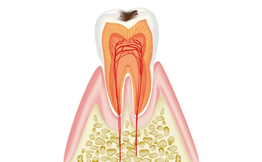 C1の特徴と治療内容