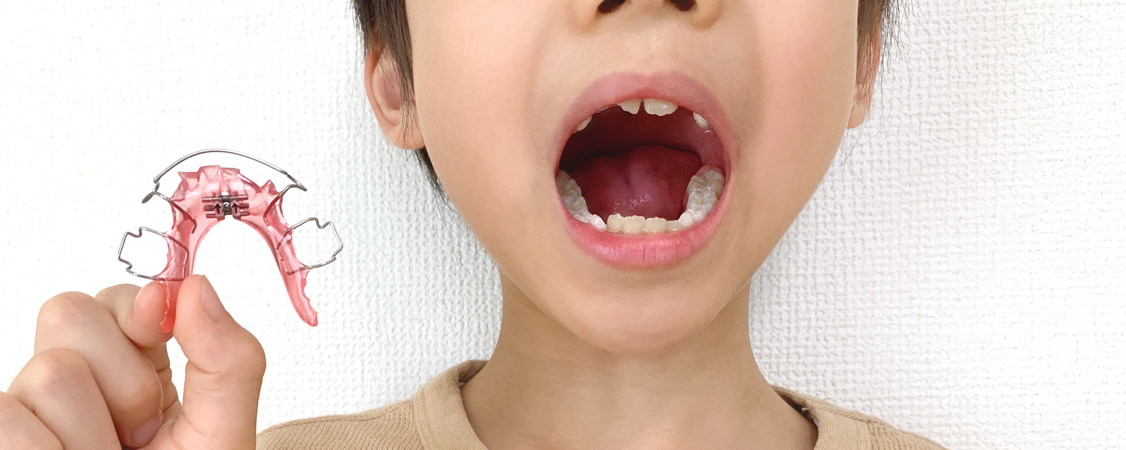 小児矯正について