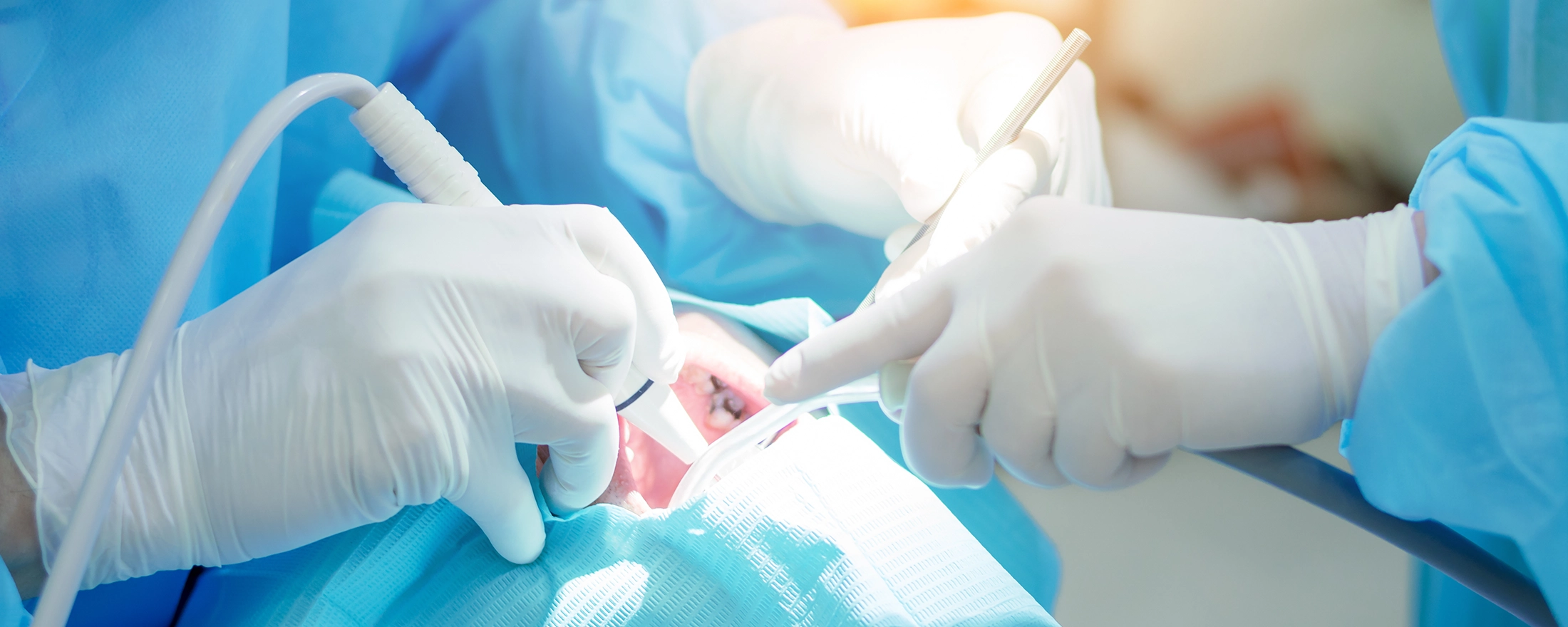 歯周外科治療とはどのような治療ですか？